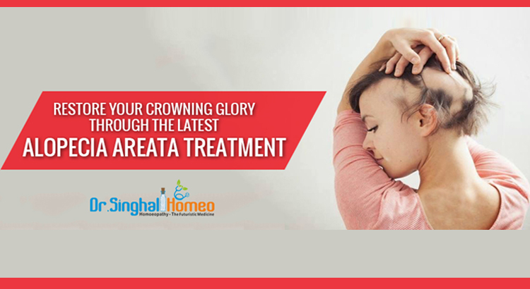 Best Alopecia Areata Homeopathic Treatment in India at Affordable Prices