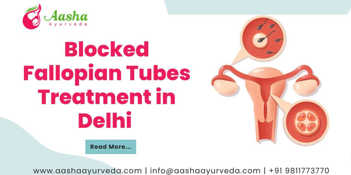 Blocked Fallopian Tubes Treatment in Delhi