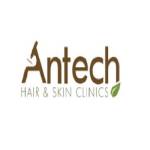 Antech Hair Clinic Profile Picture