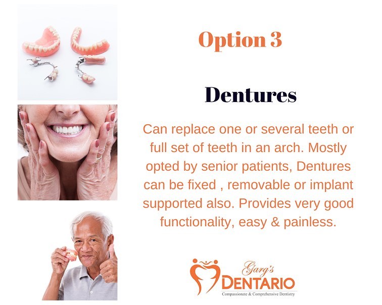 Finding a Professional Dentist in DLF Phase-1